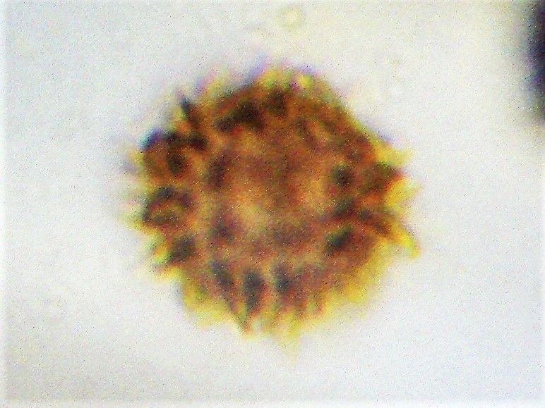 Ложнодождевик бородавчатый (Scleroderma verrucosum)
