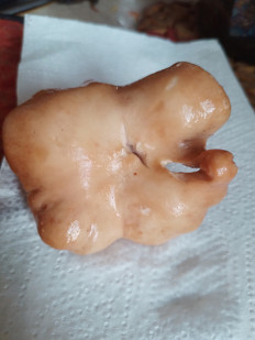 Гриб из Москва