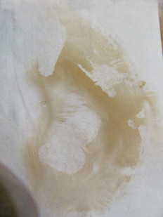 Гриб из г.Лида