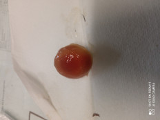 Гриб из Москва