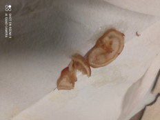 Гриб из Москва