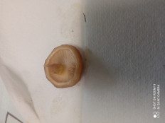 Гриб из Москва