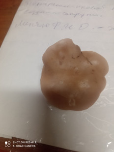 Гриб из Москва