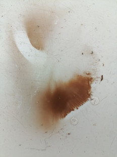 Гриб из г.Лида